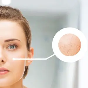 Chapter 8 - Spray tan contraindications and complications - DrySkin