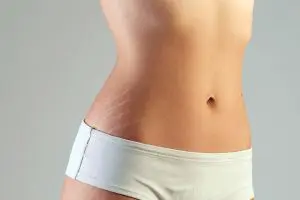 Chapter 8 - Spray tan contraindications and complications - Treat Stretch Marks In Teenagers